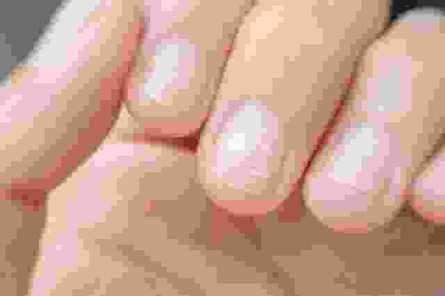 Белое пятнышко на большом пальце Появление белой точки символизирует проблемы в личной и психологической…