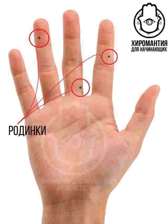 Родинки на пальцах правой руки Мизинец, безымянный, средний и указательный пальцы имеют по три…